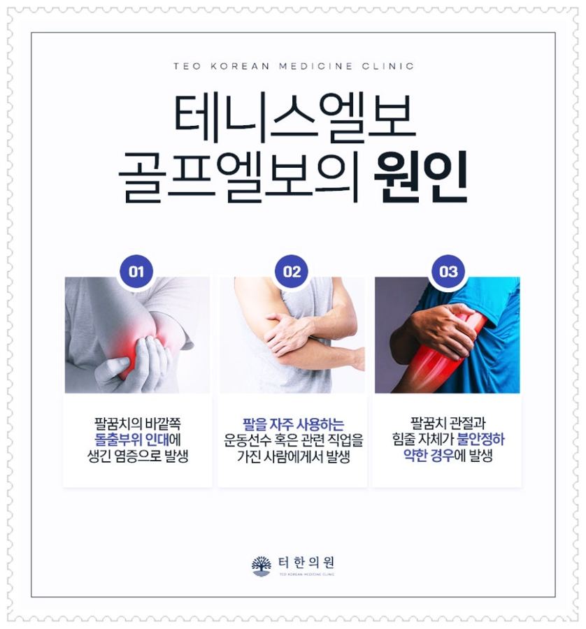 테니스엘보와 골프엘보 원인을 설명한 인포그래픽