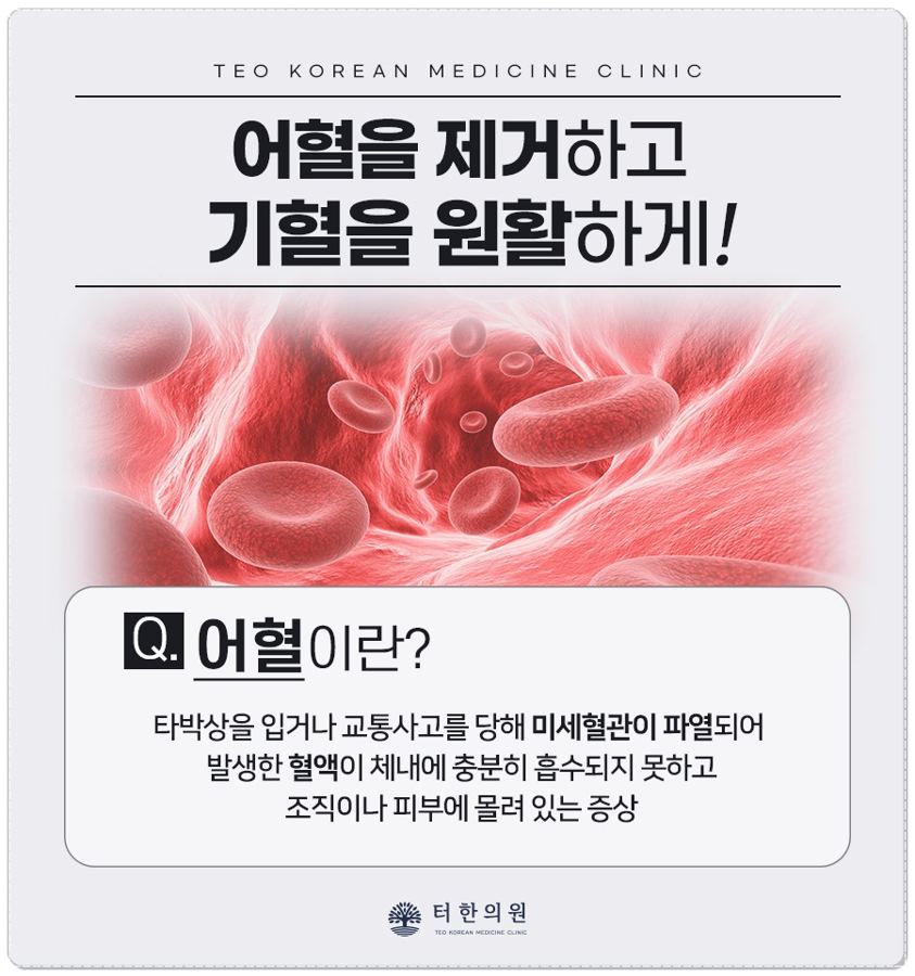 혈액 속 적혈구를 묘사한 어혈 안내문