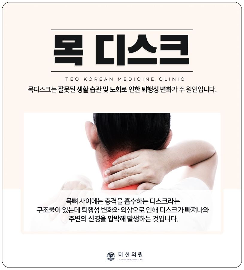목 디스크를 설명한 목 통증 사진 안내문