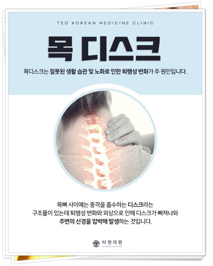 목 디스크를 설명한 안내문
