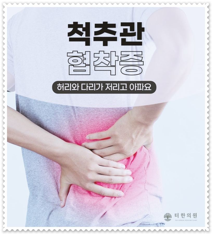 허리와 다리 통증을 표시한 협착증 안내문