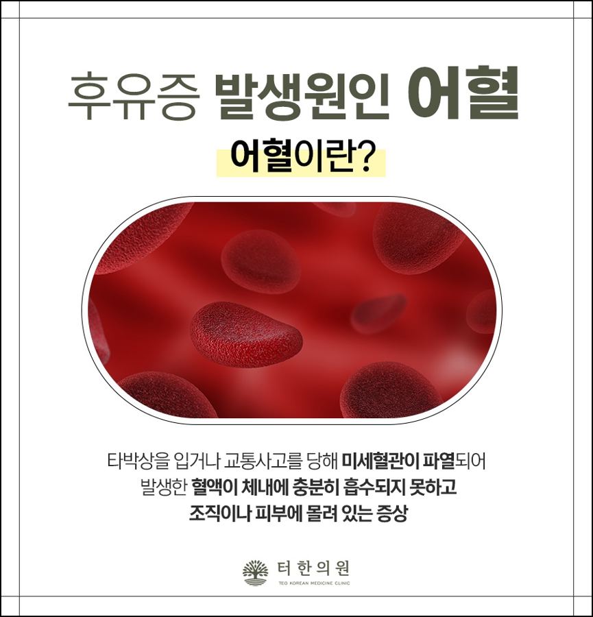 어혈을 설명한 적혈구 안내문