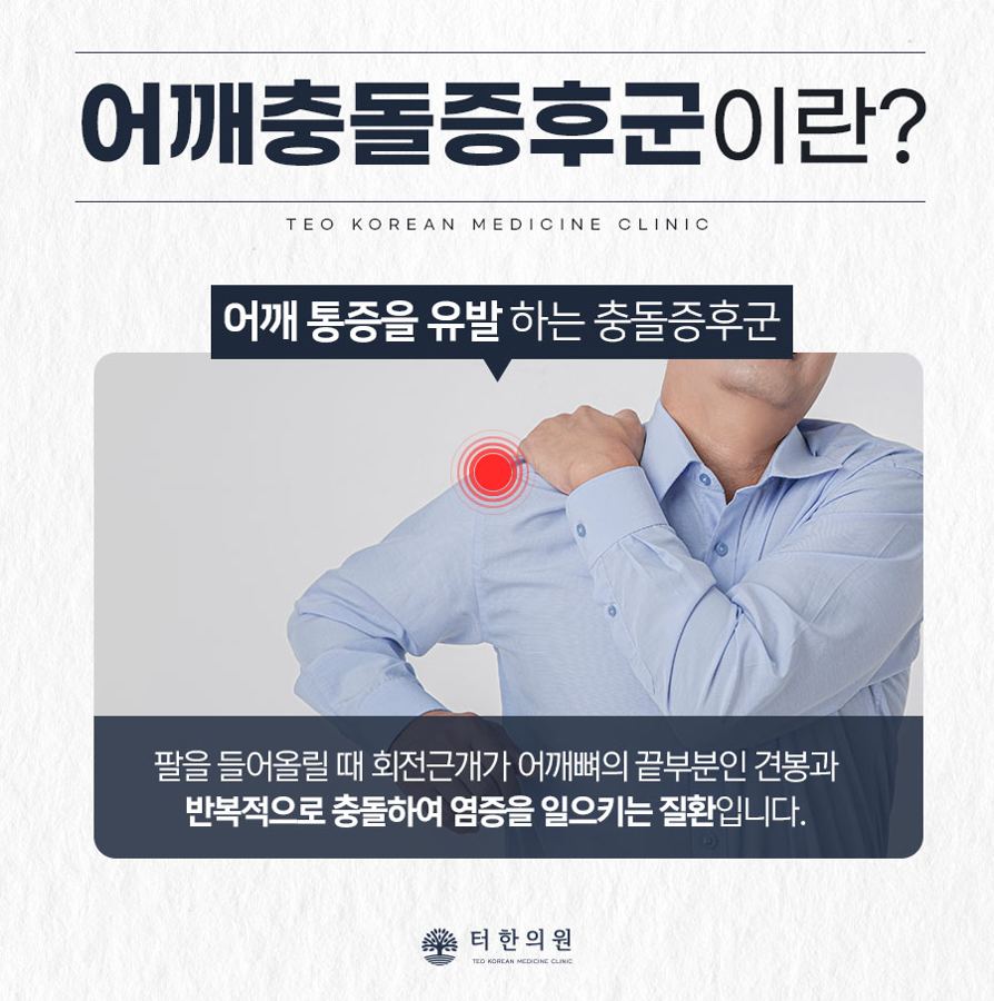 어깨충돌증후군을 설명한 남성 상반신 안내문
