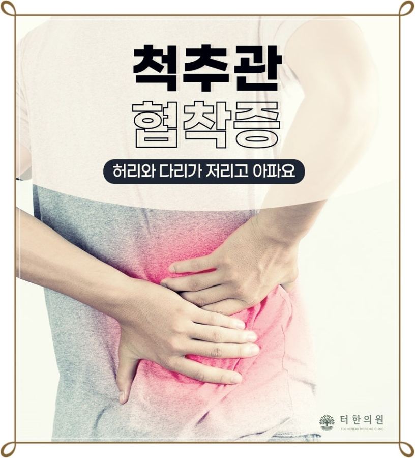 허리와 다리 저림을 표현한 모델 몸통과 척추관협착증 문구 이미지