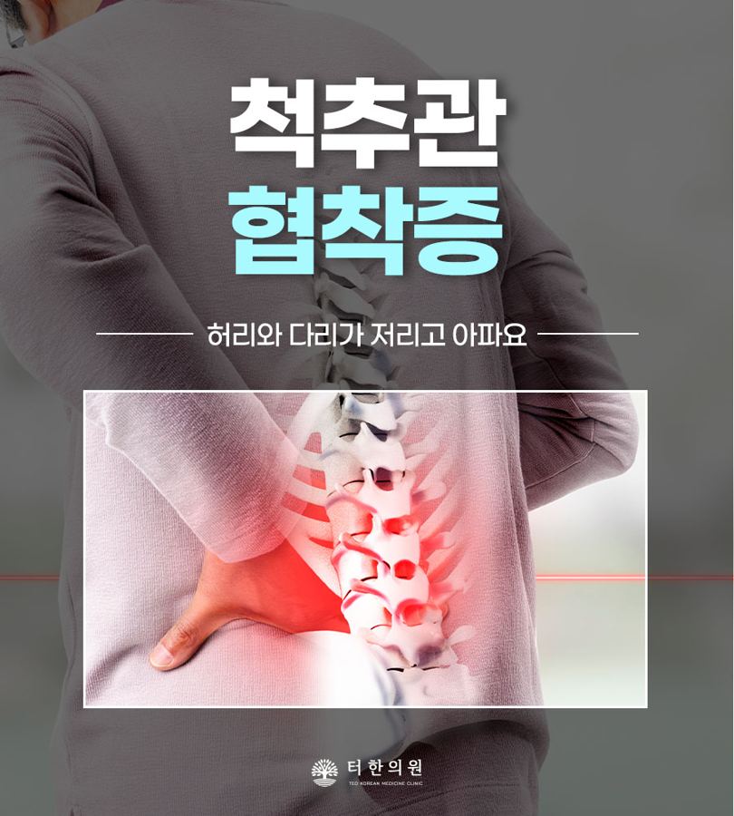 허리를 짚은 사람과 척추 모형으로 척추관협착증을 표현한 이미지