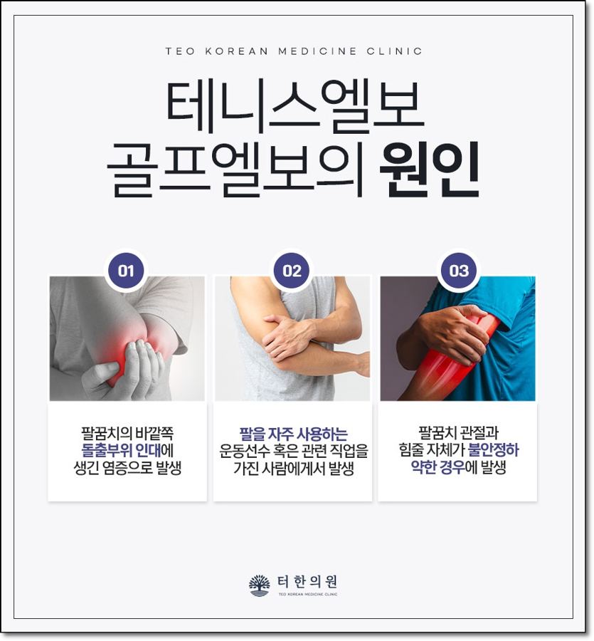 테니스엘보와 골프엘보의 세 가지 발생 원인을 설명한 이미지