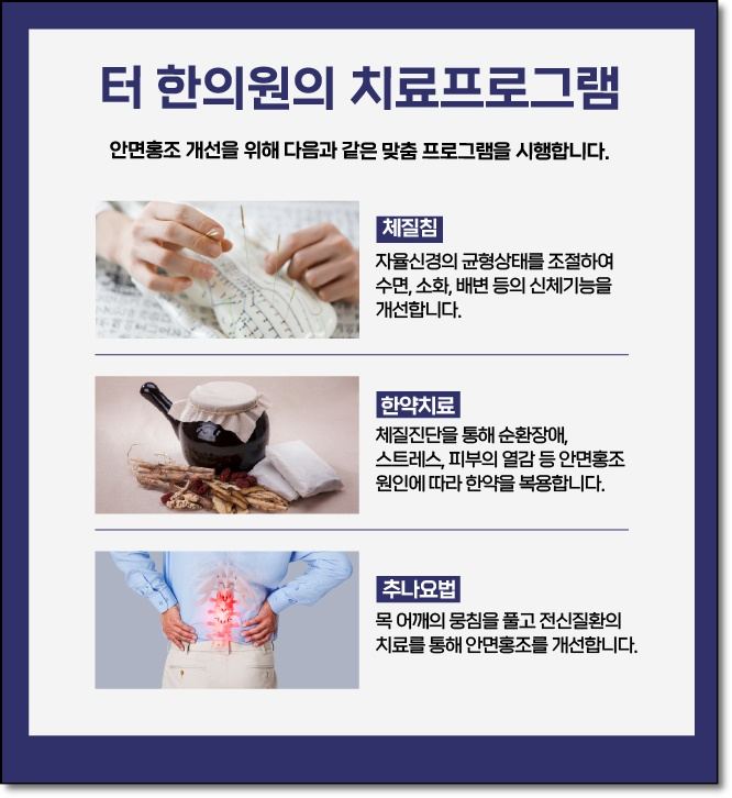 안면홍조 개선 치료 프로그램을 소개하는 카드뉴스