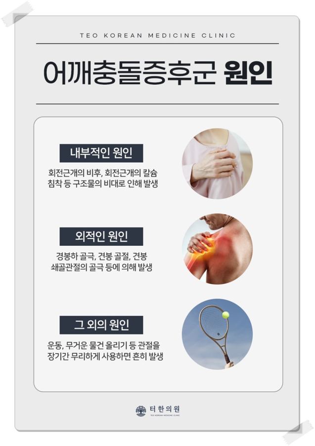 어깨충돌증후군의 내부적, 외부적, 기타 원인을 사진과 함께 설명한 이미지